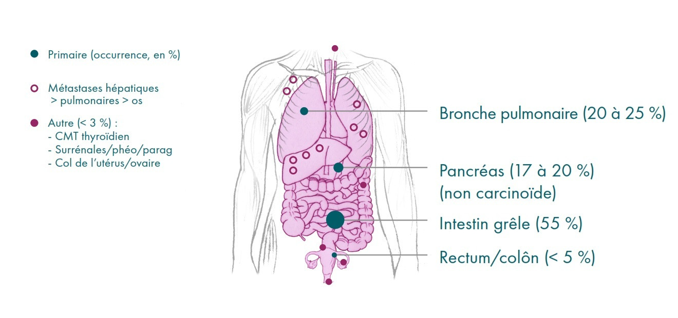 Open access FR